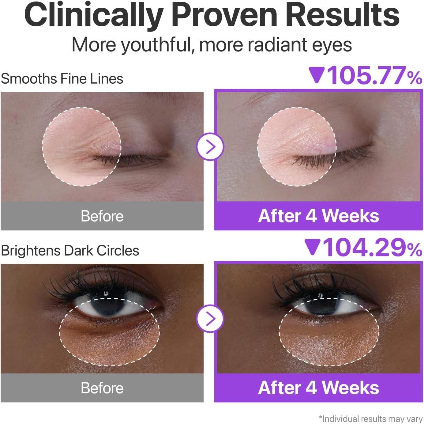 Volumetox Eye Cream 100 gm